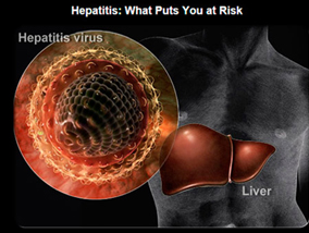 Ayurvedic Treatment for Hepatitis B