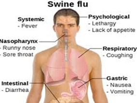 Swine flu (swine influenza) is a respiratory disease caused by viruses