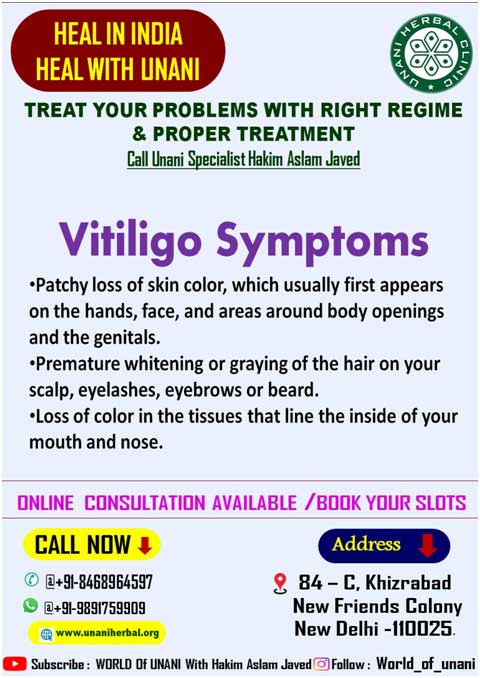 Vitiligo Symptoms, Treatment & Causes