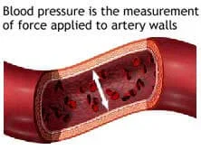 Ayurvedic medicines for High Blood Pressure