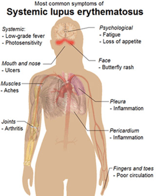 Ayurvedic Treatment and Medicine for Leucorrhoea