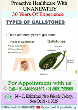 What are gallstone