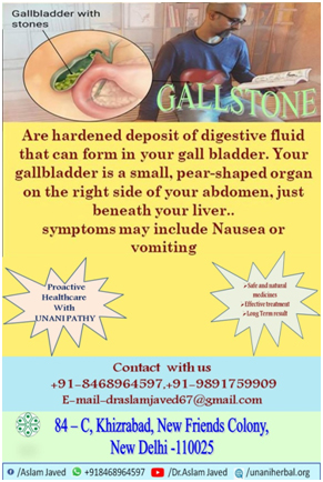 What are gallstone