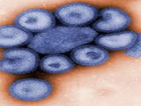 Swine flu (swine influenza) is a respiratory disease caused by viruses