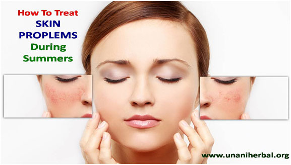 Ayurvedic treatment Psoriasis Ayurvedic treatment Psoriasis